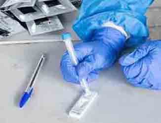 Θα υπάρχουν συνεργεία για rapid test σχεδόν σε όλα τα σχολεία