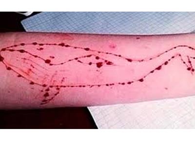 Πέντε περιστατικά τύπου «Μπλε Φάλαινας» διερευνά το Υπ. Παιδείας, καμία καταγγελία στην Αστυνομία